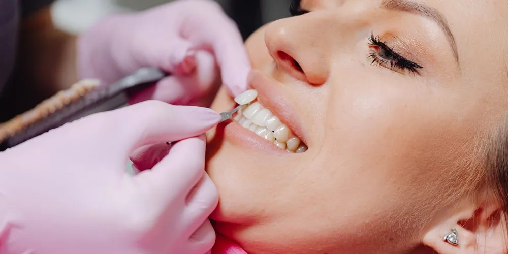 Lentes de contato dental