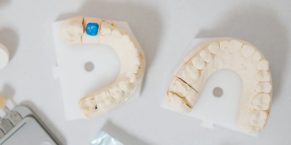 Prótese dentária